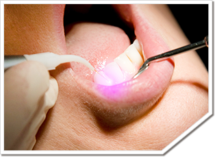 カートリッジウォーマー